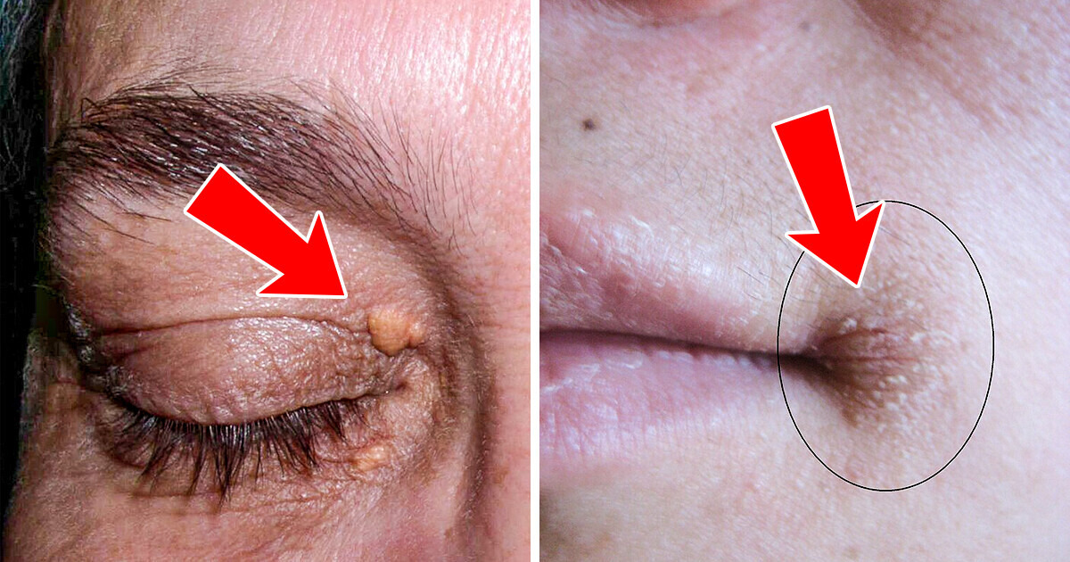 4 Signes subtils sur ton visage qui peuvent indiquer des problèmes de santé 4 Signes subtils sur ton visage qui peuvent indiquer des problèmes de santé