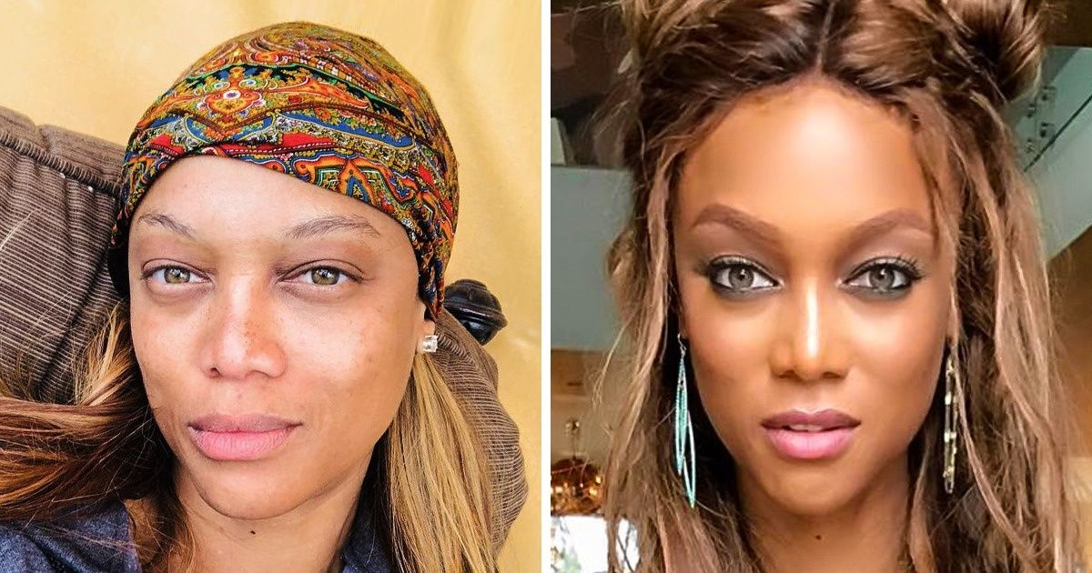 Ces femmes célèbres aiment leurs défauts et ne veulent pas avoir recours à la chirurgie esthétique pour les cacher Ces femmes célèbres aiment leurs défauts et ne veulent pas avoir recours à la chirurgie esthétique pour les cacher