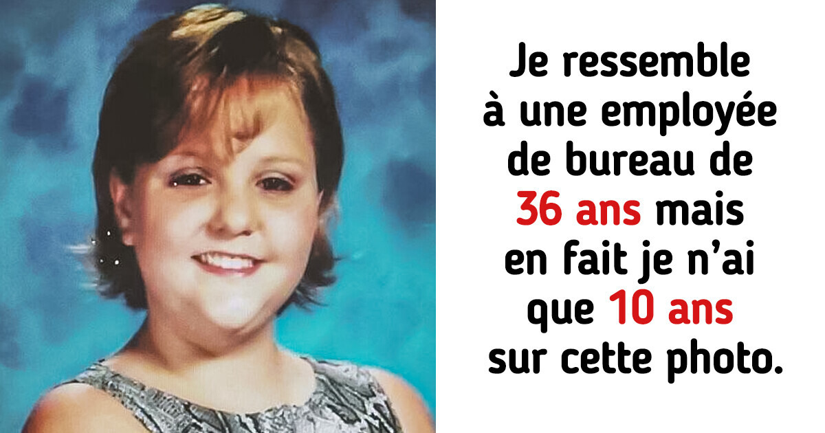 17 Personnes dont l’âge réel est aussi incroyable que l’histoire de Benjamin Button