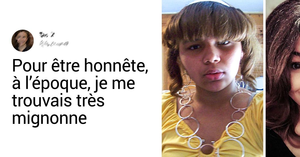 16 Personnes qui sont devenues méconnaissables en quelques années 16 Personnes qui sont devenues méconnaissables en quelques années