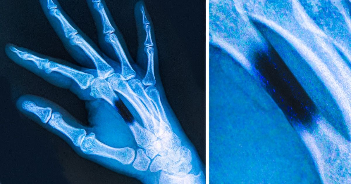 Voici les effets secondaires que peut provoquer le contact avec certains animaux Voici les effets secondaires que peut provoquer le contact avec certains animaux