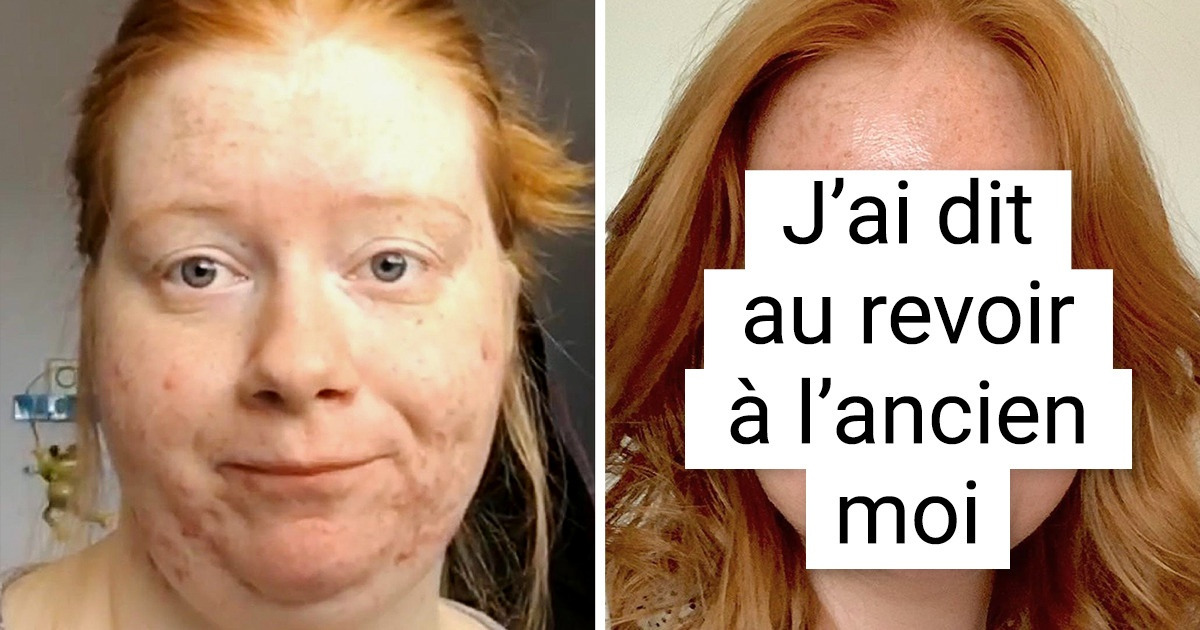 18 Personnes qui ont révélé leurs visages différents suite à une perte de poids importante