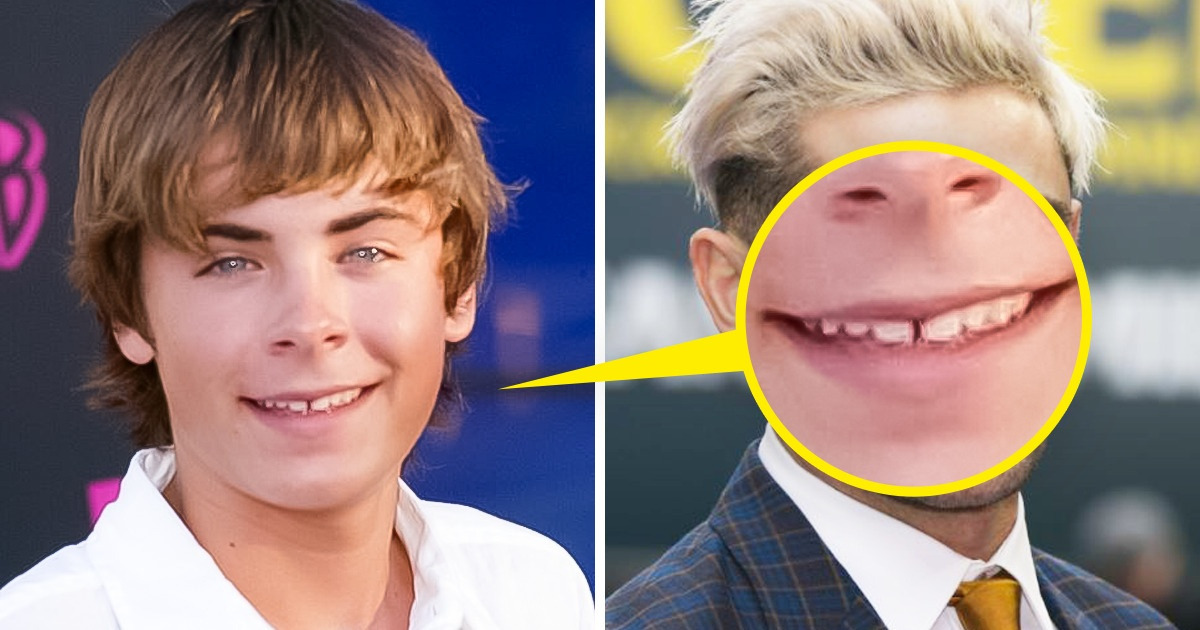 Voici à quoi ressemblent 12 célébrités après un passage chez le dentiste