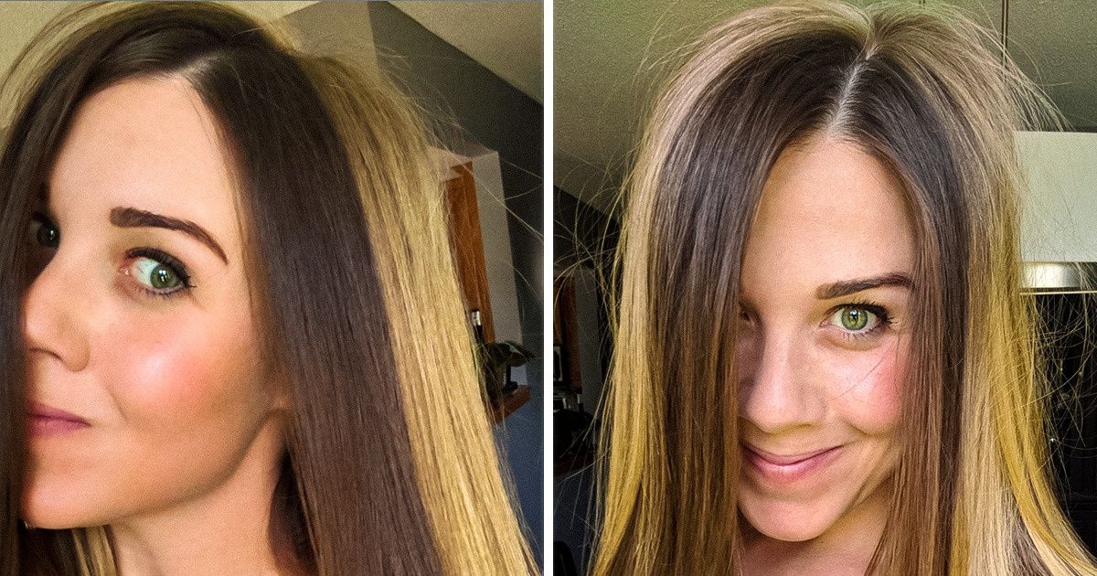 8 mutations génétiques qui donnent à leurs porteurs un charme particulier 8 mutations génétiques qui donnent à leurs porteurs un charme particulier