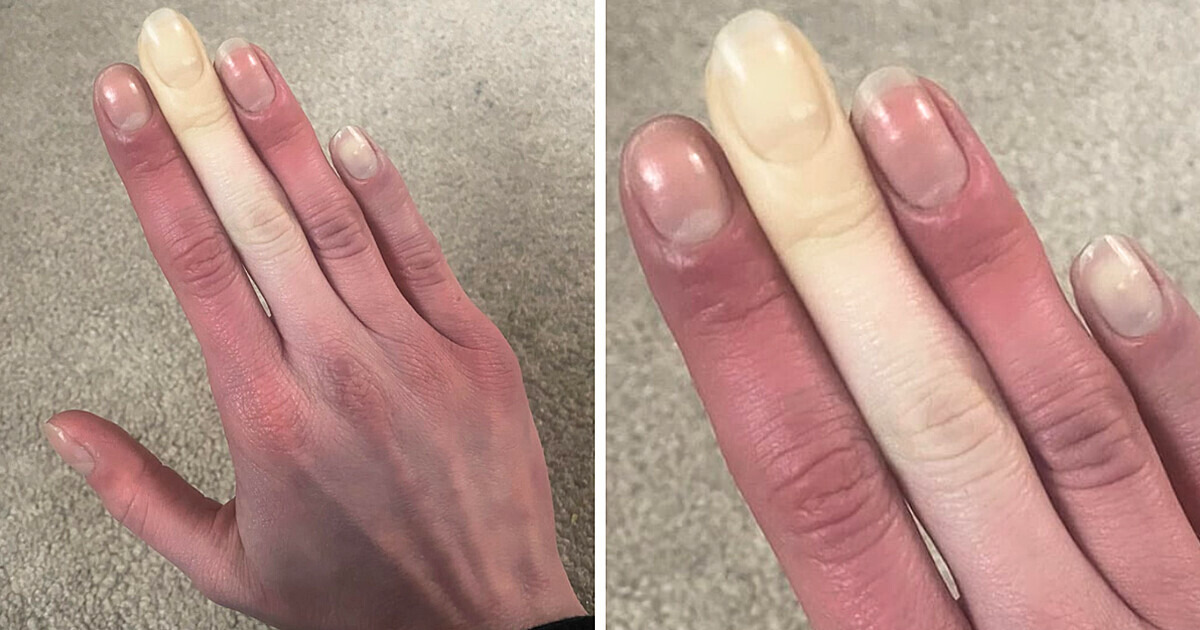 12 Fois où le corps humain a décidé d’être super créatif