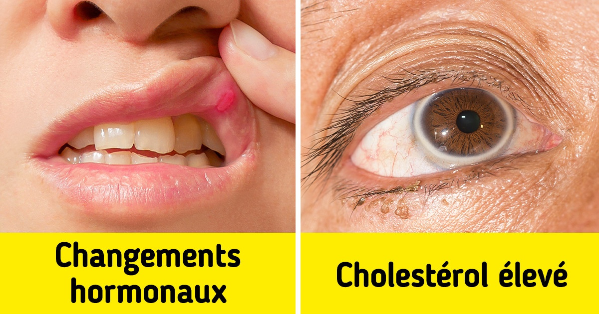 8 Signaux d’alarme que ton corps te donne et que tu ne dois pas ignorer 8 Signaux d’alarme que ton corps te donne et que tu ne dois pas ignorer
