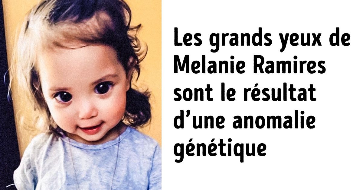 15 Personnes devenues célèbres grâce à leur physique unique