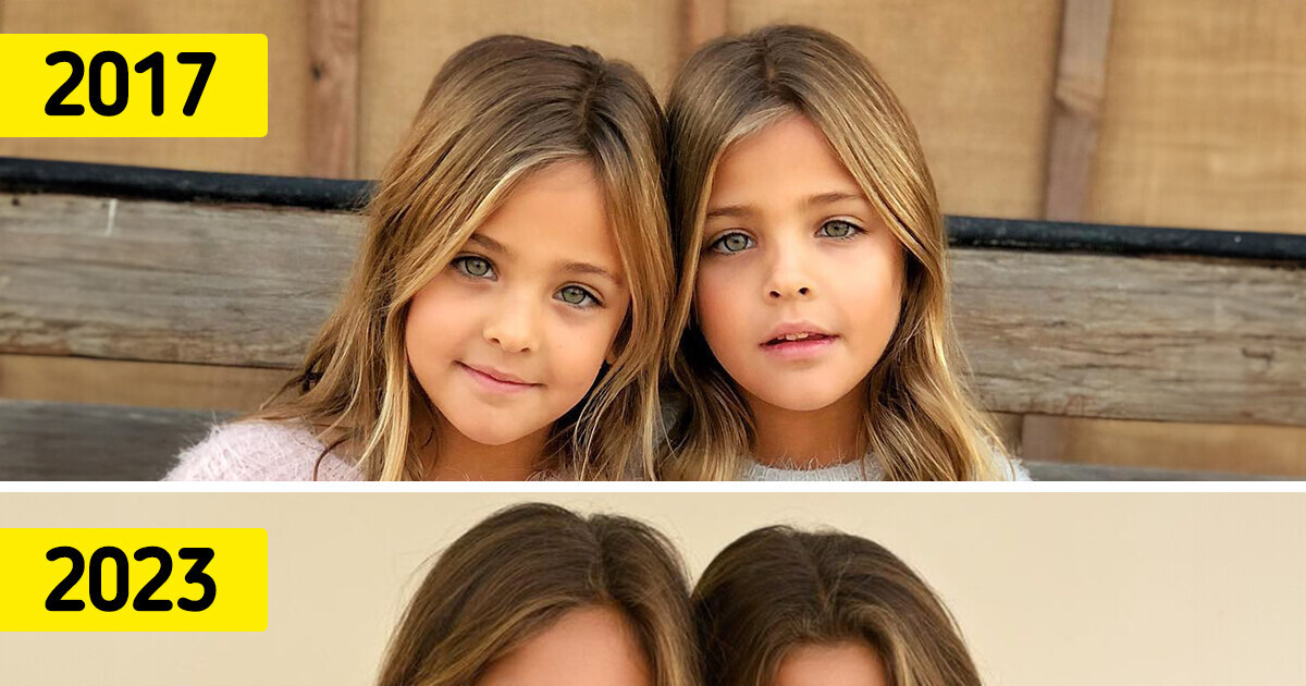 Les plus belles jumelles du monde ont bien grandi et voici à quoi elles ...