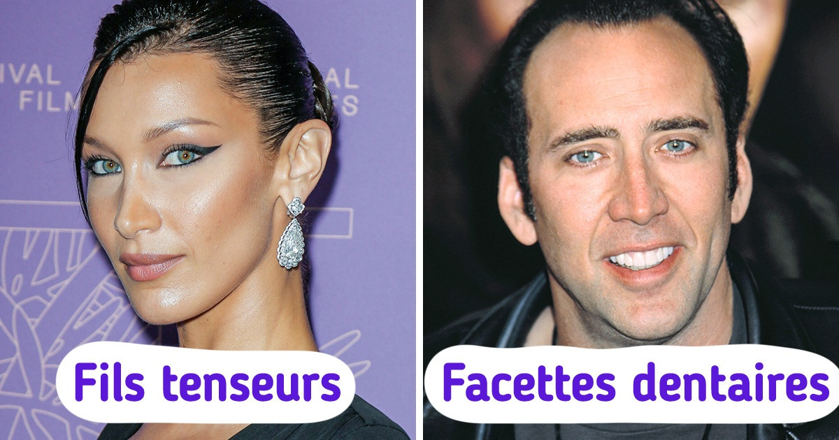 10 Traitements esthétiques qui étaient jusqu’à récemment réservés aux riches que tu as peut-être déjà essayés