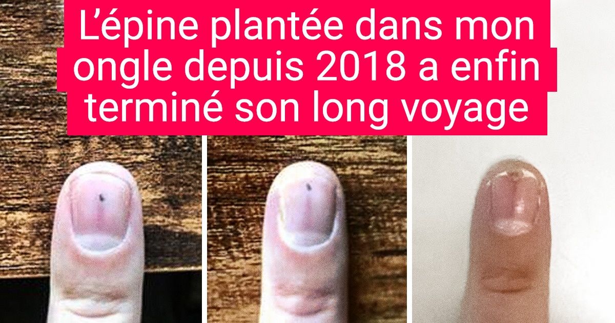 20 Personnes qui ont découvert des choses plus difficiles à trouver qu’un trèfle à quatre feuilles
