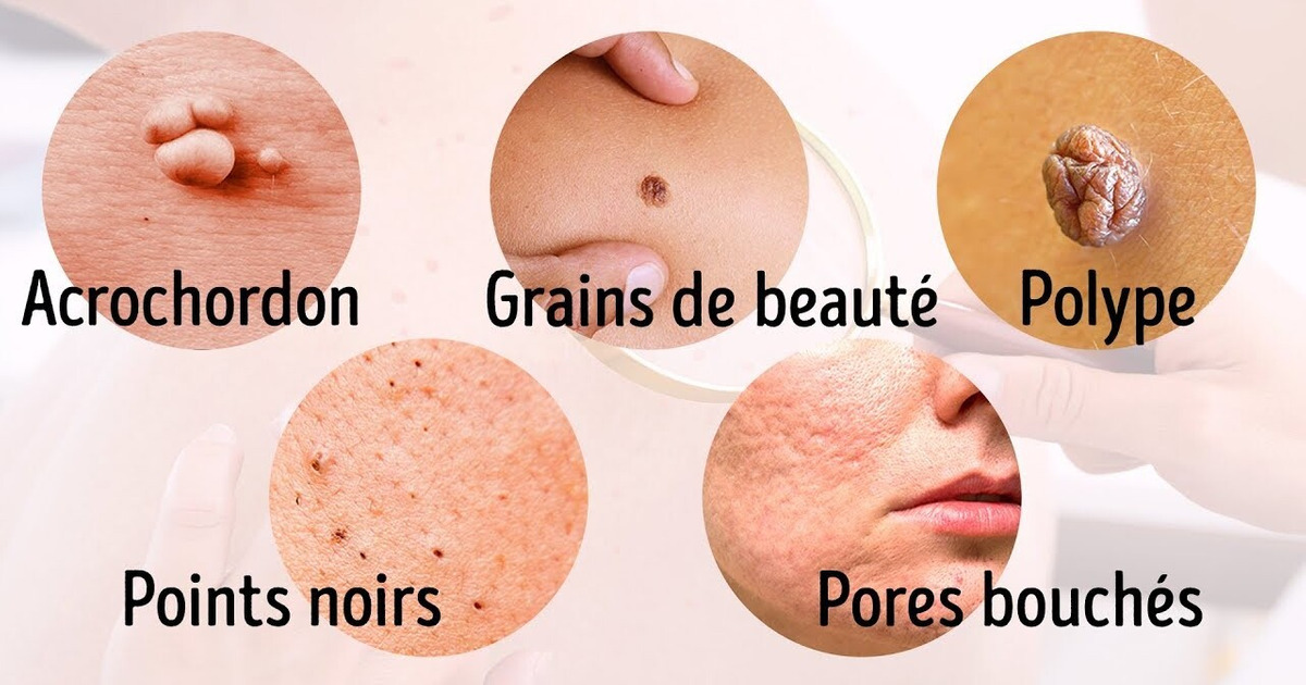 8 Maladies Graves Que Notre Peau Nous Signale