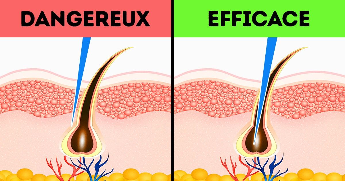 14 Clichés sur l’épilation qui ne sont plus valables au XXIe siècle 14 Clichés sur l’épilation qui ne sont plus valables au XXIe siècle