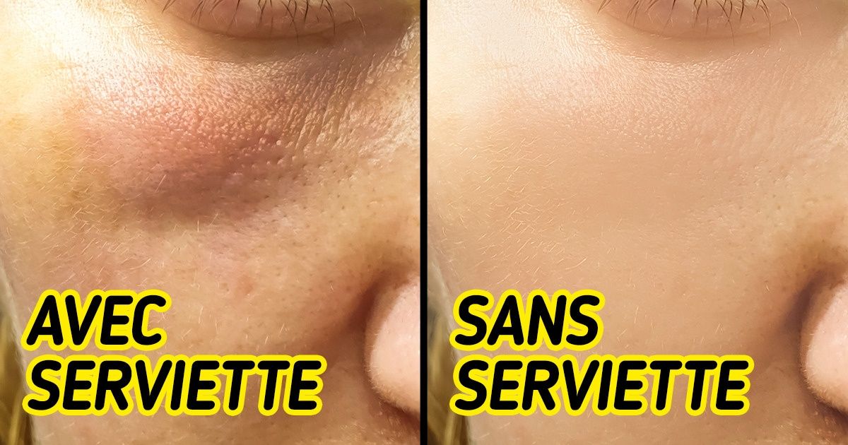 Voici pourquoi tu devrais éviter d’utiliser une serviette pour te sécher le visage