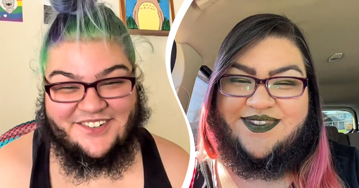 Cette femme à barbe répond aux critiques sur son apparence : “Je m’aime... Mon petit ami m’aime” Cette femme à barbe répond aux critiques sur son apparence : “Je m’aime... Mon petit ami m’aime”