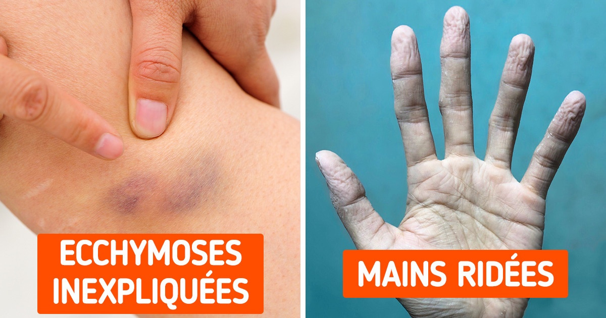 11 Signes qui révèlent que ton corps te donne des alertes importantes 11 Signes qui révèlent que ton corps te donne des alertes importantes