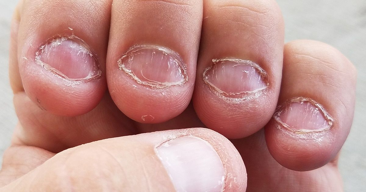 10 Conseils pour arrêter une bonne fois pour toutes de te ronger les ongles