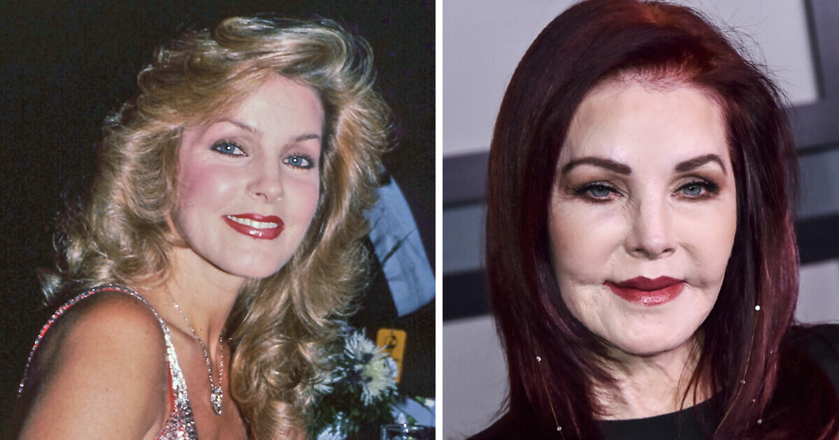 13 Avant-après de stars que la chirurgie esthétique a totalement transformées