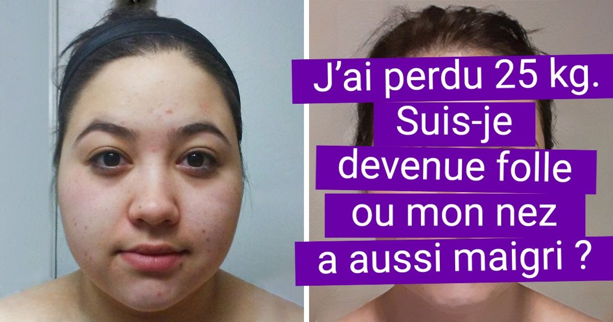 20 Photos qui montrent le progrès fait avec le temps