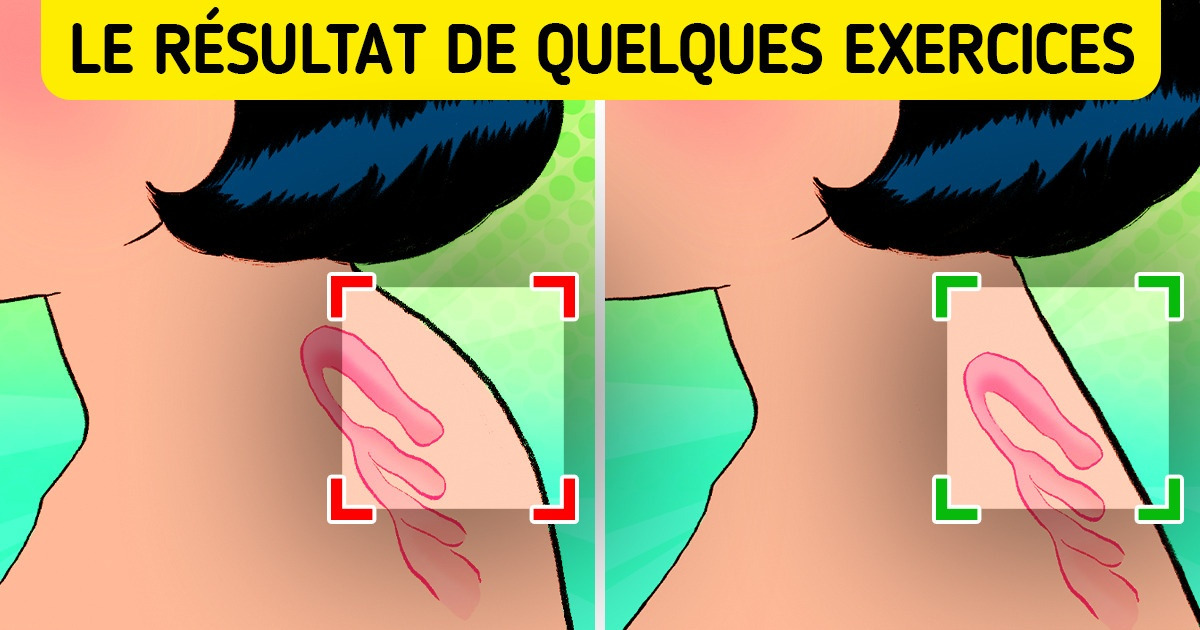 10 Exercices simples contre le mal de dos et la bosse de bison