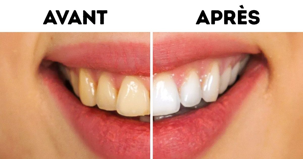 Les dentistes révèlent 10 manières simples de prévenir les caries