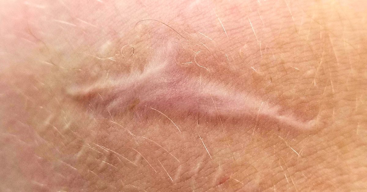 20+ Phénomènes étonnants qui sont arrivés par hasard