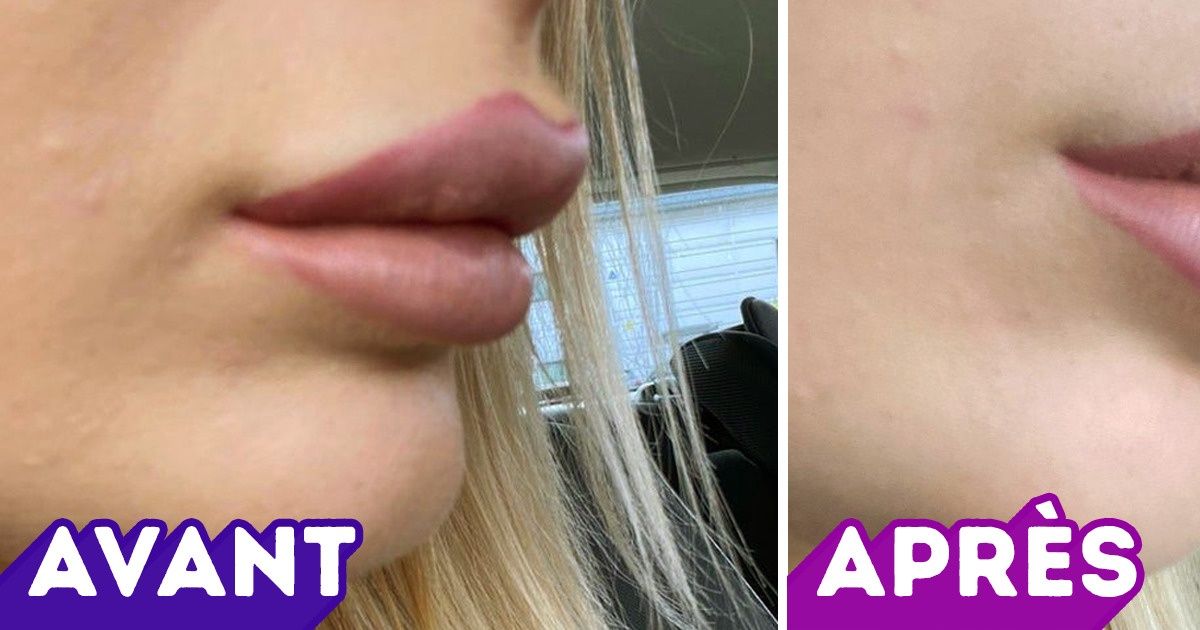 18 Filles qui ont voulu modifier leur apparence mais ont changé d’avis