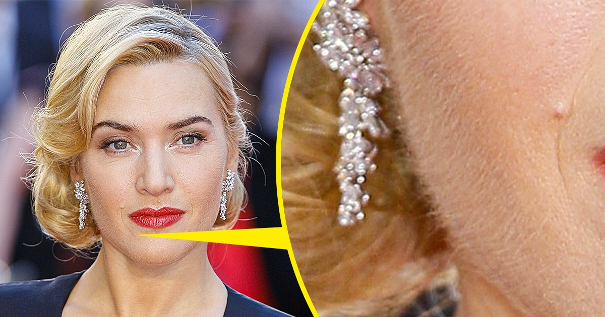 18 Célébrités qui ont dit non aux normes de beauté notoires et se sont autorisées à être elles-mêmes