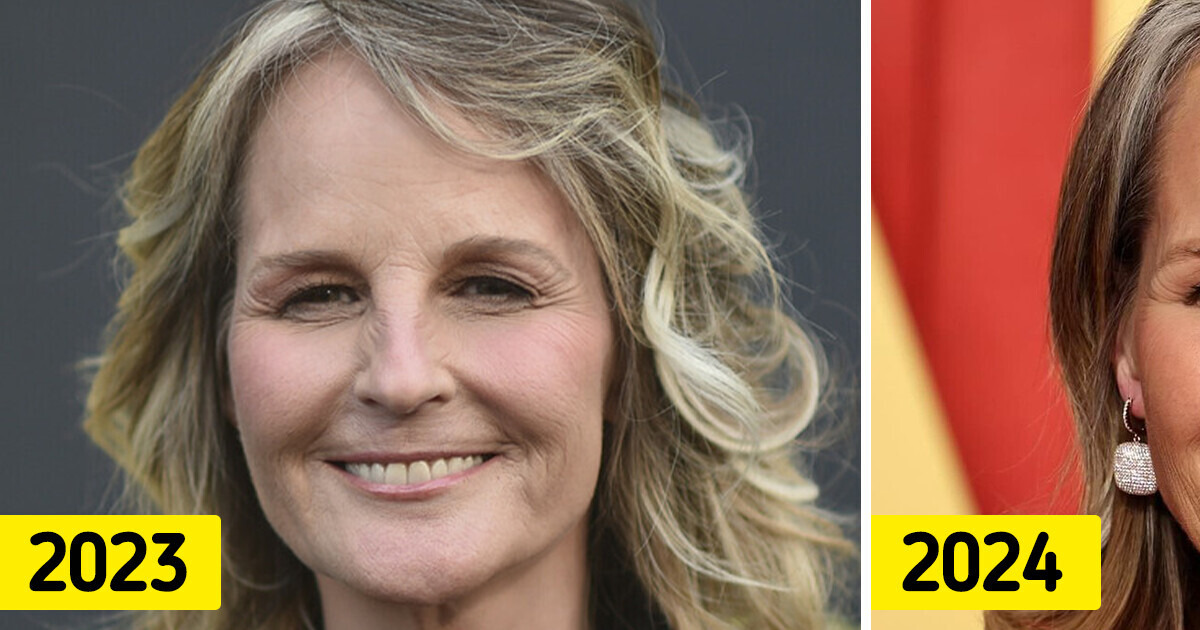 Helen Hunt, 60 ans, laisse internet stupéfait lors de sa récente apparition et tout le monde parle de ses lèvres Helen Hunt, 60 ans, laisse internet stupéfait lors de sa récente apparition et tout le monde parle de ses lèvres