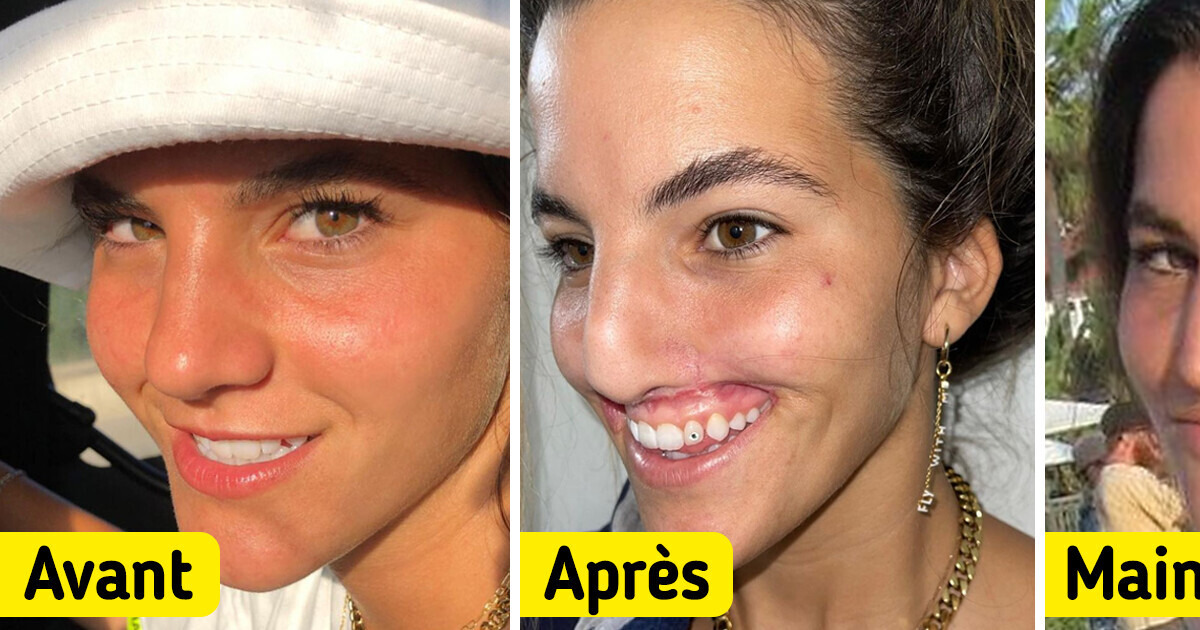 Un mannequin se fait mordre la lèvre par un chien et elle partage son épopée très inspirante Un mannequin se fait mordre la lèvre par un chien et elle partage son épopée très inspirante