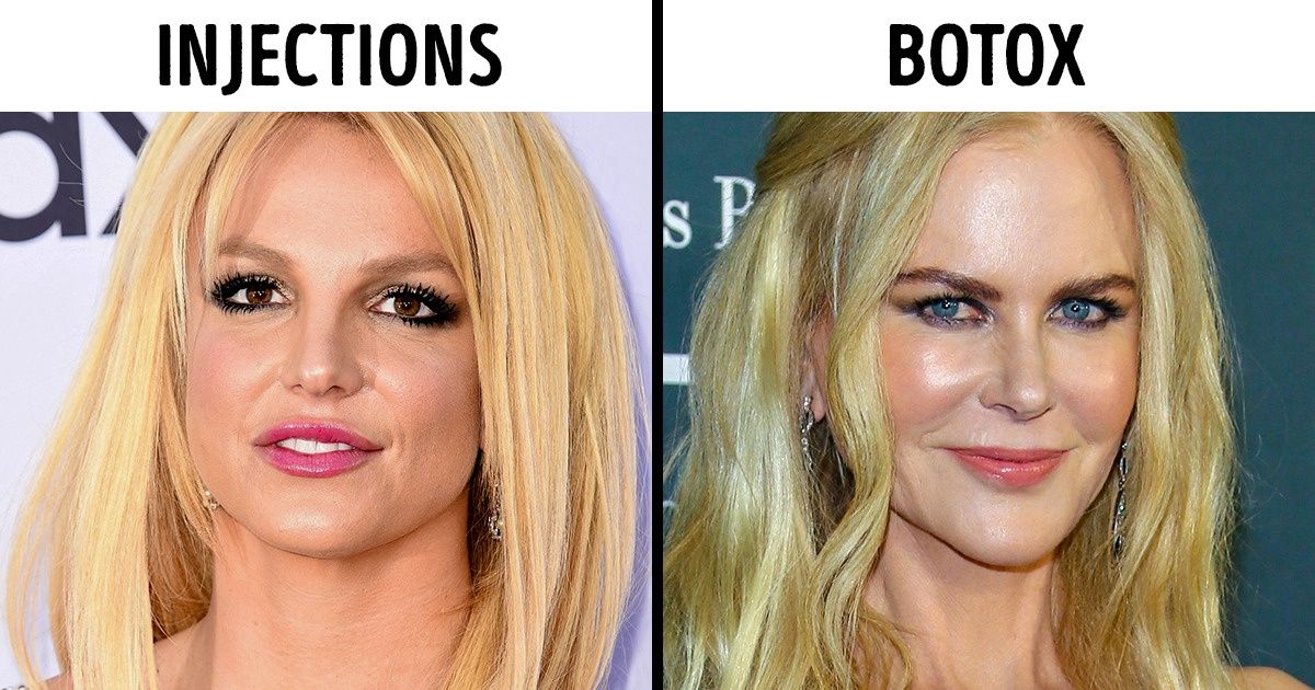 18 Célébrités qui ont subi des opérations de chirurgie esthétique et n’ont pas hésité à le dire 18 Célébrités qui ont subi des opérations de chirurgie esthétique et n’ont pas hésité à le dire