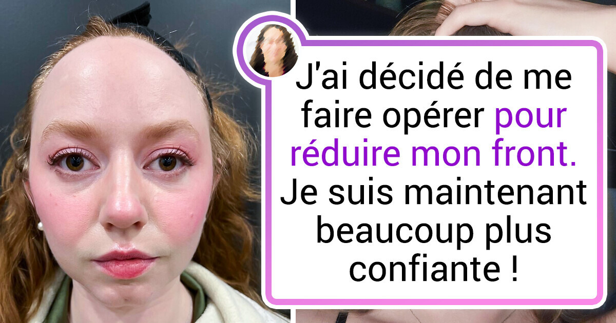 20+ Photos qui expliquent mieux que mille mots ce qu’est une grande différence 20+ Photos qui expliquent mieux que mille mots ce qu’est une grande différence