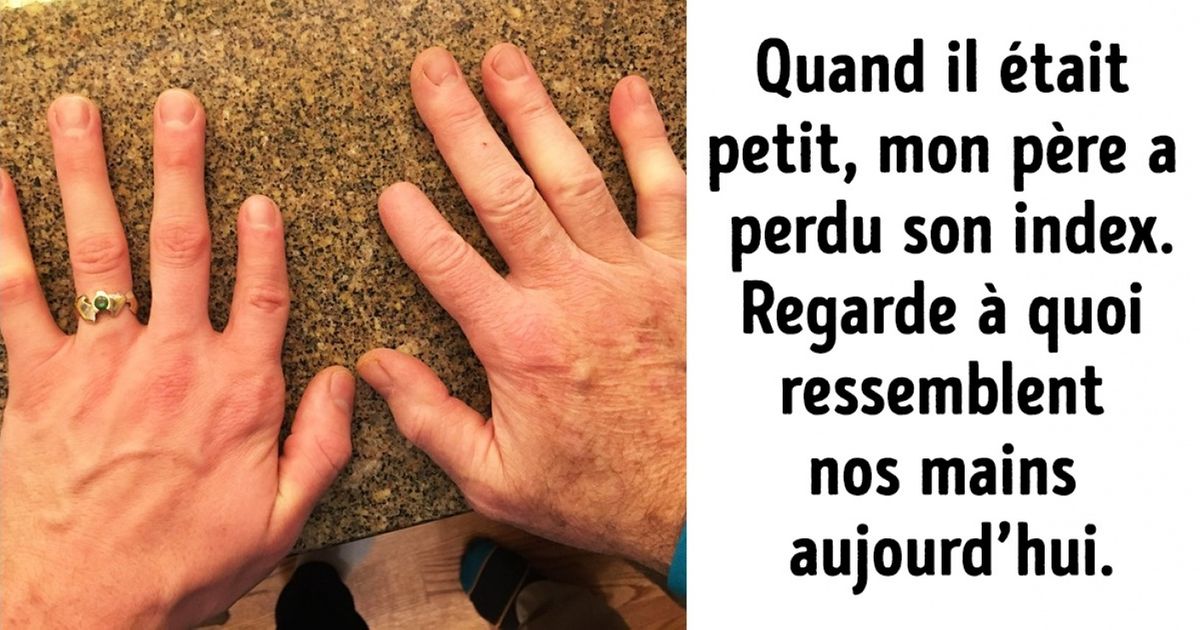 Ces 25 enfants ont hérité, de leurs parents, certaines caractéristiques physiques particulières