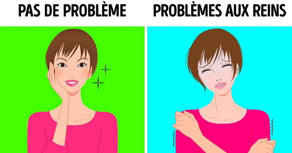 10 Signes Qui Indiquent Que Tes Reins ne Fonctionnent Pas Correctement 10 Signes Qui Indiquent Que Tes Reins ne Fonctionnent Pas Correctement