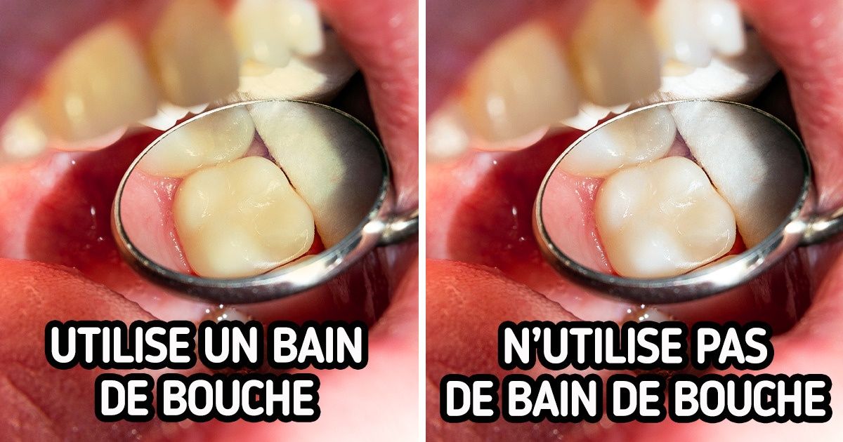 7 Habitudes quotidiennes qui ternissent tes dents