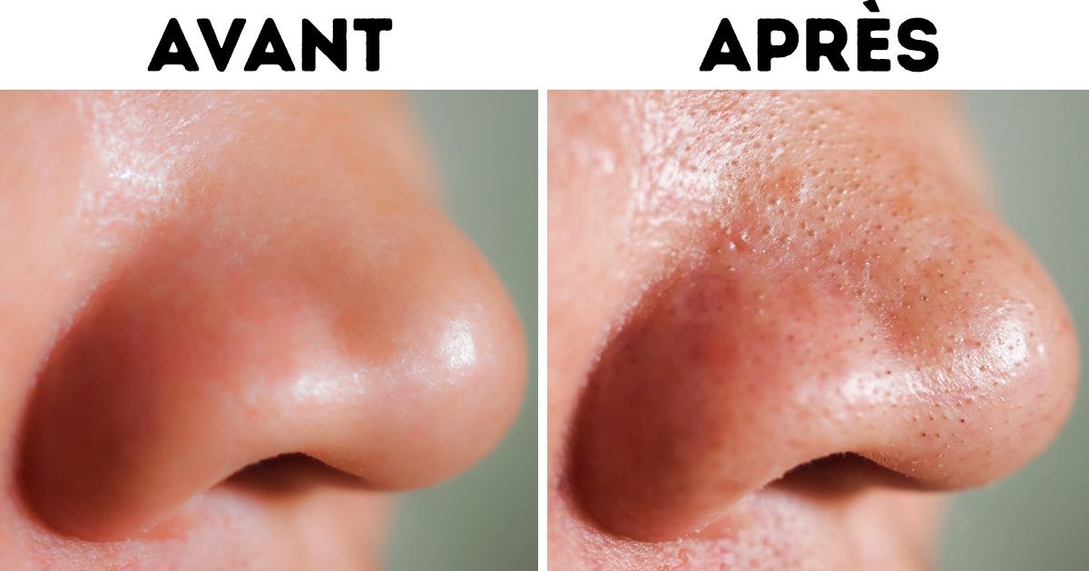 6 Tristes conséquences que les lingettes démaquillantes peuvent provoquer sur ta peau