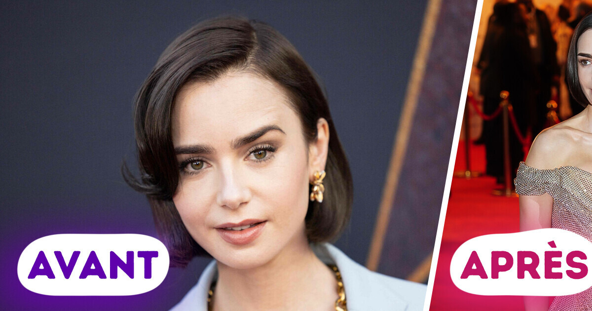 “Pourquoi les implants sont-ils si mauvais ?” Lily Collins surprend la toile lors de sa récente apparition publique “Pourquoi les implants sont-ils si mauvais ?” Lily Collins surprend la toile lors de sa récente apparition publique