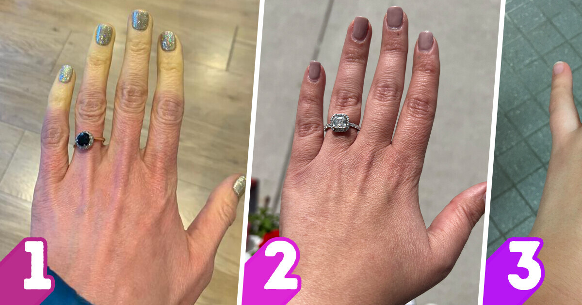 10 Choses que tes mains peuvent révéler sur ton état de santé 10 Choses que tes mains peuvent révéler sur ton état de santé