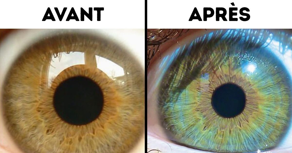 Peut-on avoir des yeux qui changent de couleur avec le temps ?