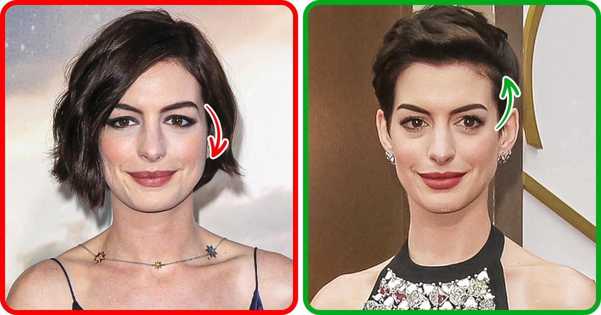 10 Imperfections faciales qui peuvent être facilement dissimulées avec la coiffure