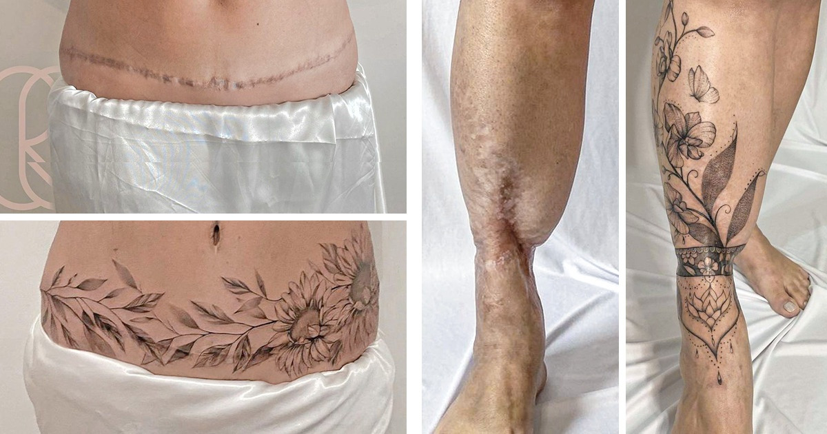 15 Personnes qui ont récupéré leur estime de soi après avoir transformé leurs cicatrices en de véritables chefs-d’œuvre 15 Personnes qui ont récupéré leur estime de soi après avoir transformé leurs cicatrices en de véritables chefs-d’œuvre