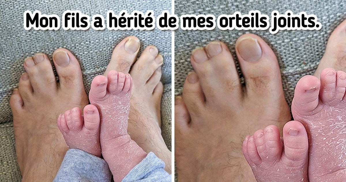 15 Photos qui prouvent que nos différences sont des super-pouvoirs dont nous devrions être fiers