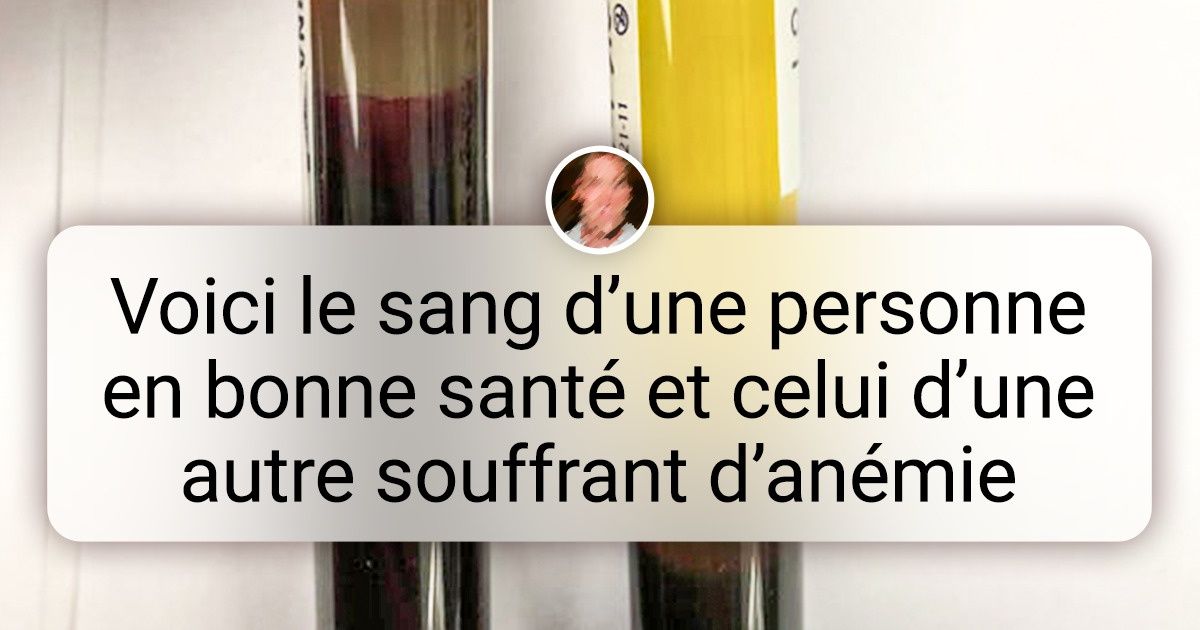 18 Photos contrastées qui t’expliqueront ce qu’il te faut normalement chercher sur Google
