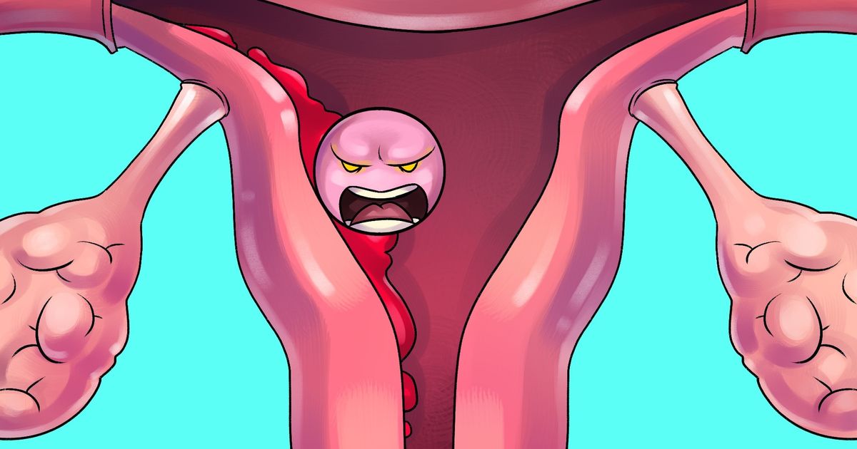 Suis ces 13 conseils pour éviter les douleurs menstruelles et survivre à cette délicate période du mois