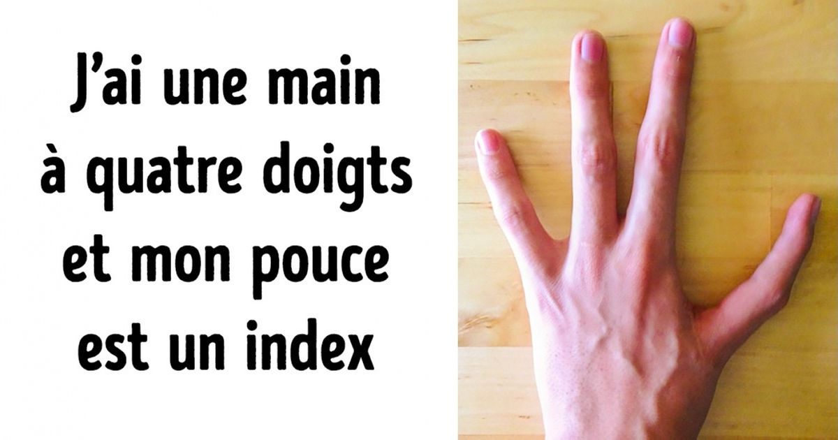 S’il y avait une liste d’images bizarres que tu devais absolument voir avant de mourir, elle serait composée de ces 24 photos