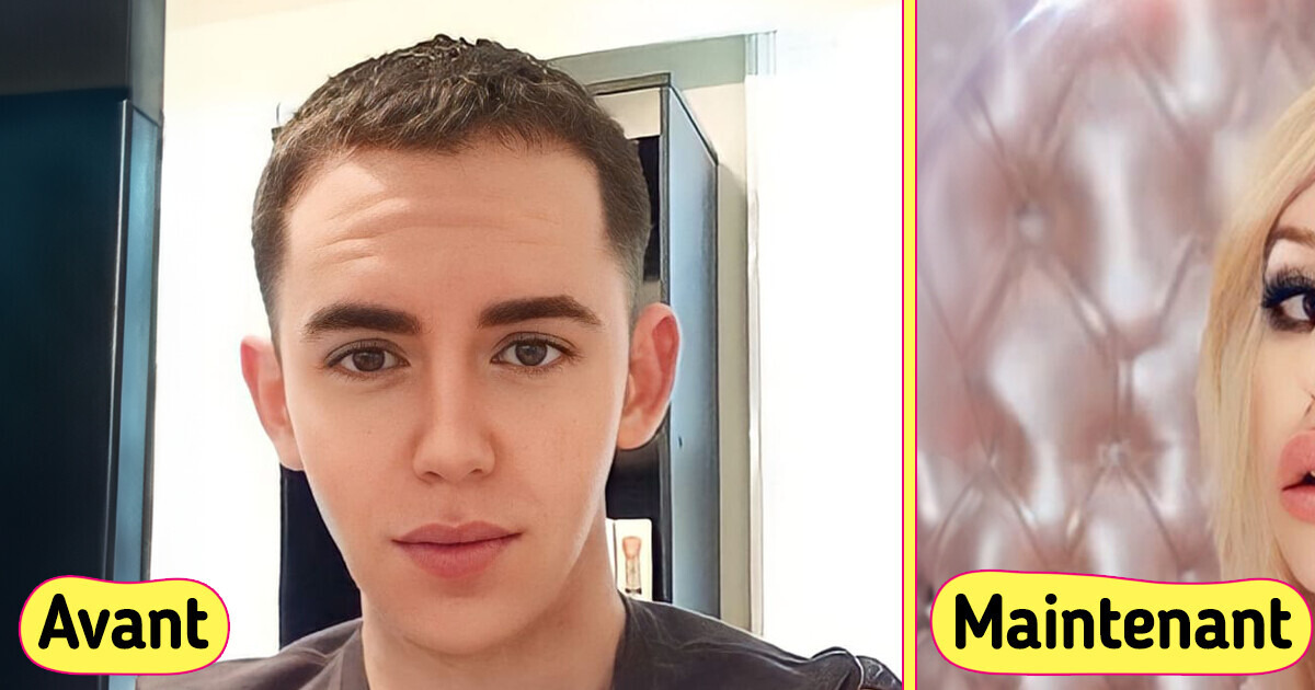 J’ai dépensé plus de 100 000$ en chirurgie plastique pour me transformer en Britney Spears