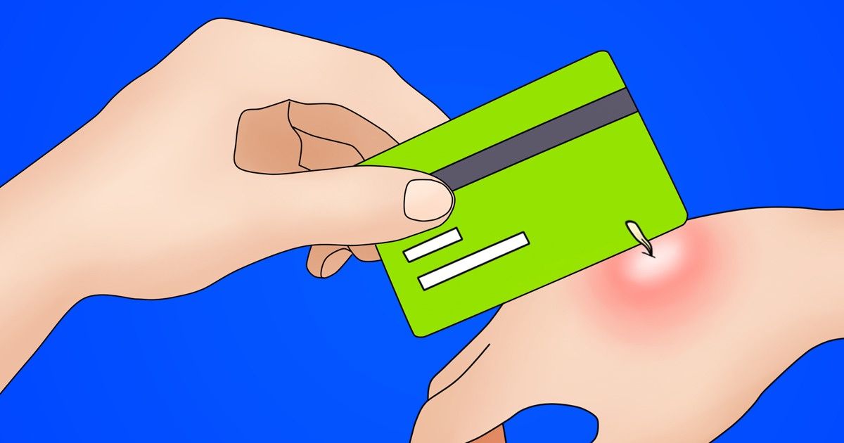 10 utilisations étonnantes d’objets du quotidien qui pourraient un jour te sauver la vie ! 10 utilisations étonnantes d’objets du quotidien qui pourraient un jour te sauver la vie !