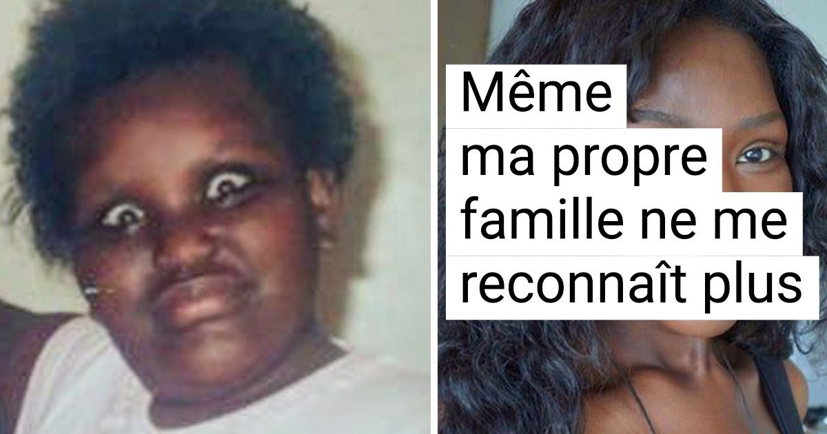 20 Personnes qui n’étaient pas satisfaites de leur physique et ont décidé de changer