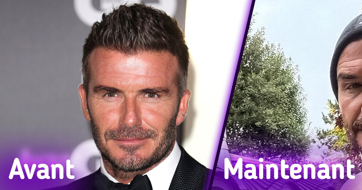 “Trop de Botox”, le visage gonflé de David Beckham sur ses dernières photos suscite une vive controverse