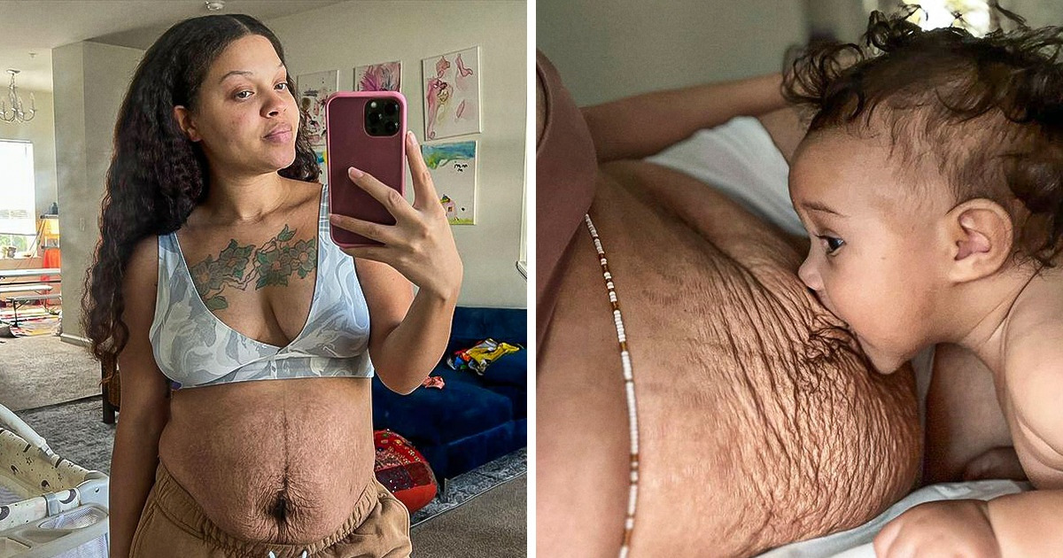 Une femme montre la vérité des corps post-partum