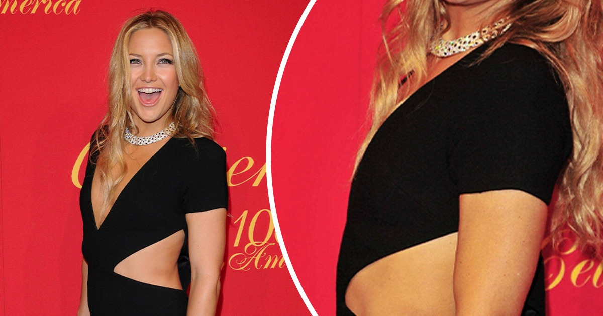 16 Femmes célèbres qui ne se soucient pas des normes de beauté et se permettent d’être elles-mêmes 16 Femmes célèbres qui ne se soucient pas des normes de beauté et se permettent d’être elles-mêmes